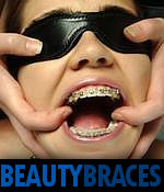 Beauty and Braces Teen Model
